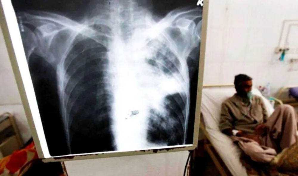 Detectaron un caso de tuberculosis en un colegio de Mar del Plata y activaron el protocolo sanitario